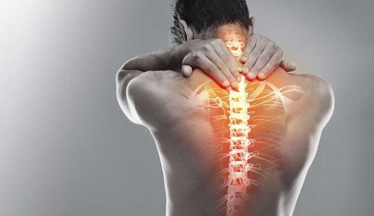 Starke Schmerzen im mittleren Rücken ein Zeichen für eine Schädigung der Wirbelsäule