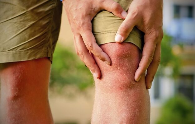 Klinisches Bild der Arthrose