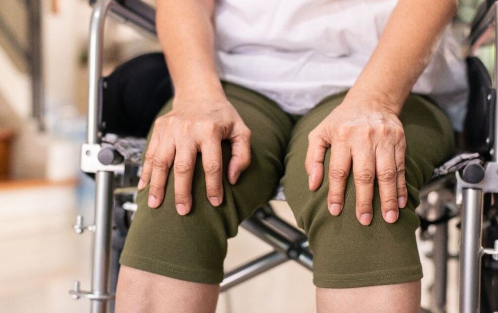 Ein Patient mit Arthrose der Kniegelenke. 